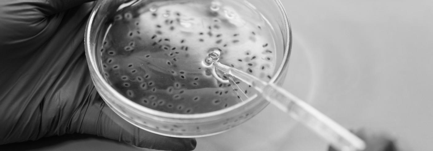 A petri dish